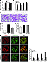 Podocyte-specific Raptor-heterozygous mice show resistance to the developme