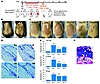 In vivo ablation of skin cells in Krt14-CreER;Mos-iCsp3 double transgenics.