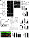 In vitro and in vivo ablation of auditory hair cells in Pouf4f3-Cre;Mos-iCs