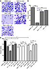 HBMEC cytotoxicity and cell viability assays.