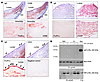 IgE and FcεR1α expression in human atherosclerotic lesions and in human mac