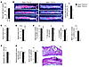 Deficiency of FcεR1α reduced atherogenesis in Apoe–/– mice.