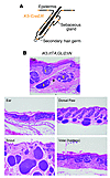 Induction of GLI2ΔN expression leads to BCC-like tumors derived from all 3