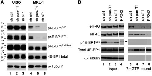 MCV sT knockdown in MCV-infected MCC cells reduces 4E-BP1 hyperphosphory...