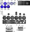 MCV sT induces PP2A-binding and DnaJ domain–independent transformation of R