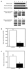 PCR amplifications of spirochetal DNA (flaB) from blood and brains. (a) Rep