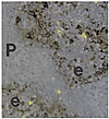 HIV-1–expressing cells are present in the thymic perivascular space as well