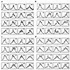 Analysis of TCR Vβ repertoire diversity by spectratype analysis of TCR Vβ C