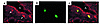 Confocal image of dual immunofluorescent staining showing colocalization of