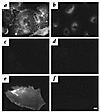 CAR expression on primary human fibroblasts. Twenty-four hours after infect