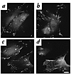 αV integrin in AdCAR- and AdNull-infected fibroblasts. Twenty-four hours af