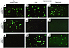 GM2 ganglioside and oligosaccharide accumulation in tissues. Immunofluoresc