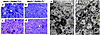 Comparison of pathology between double knockout (Hexb–/–GalNAcT–/–) and sin