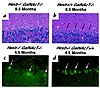 Purkinje cell degeneration in the Hexb–/–GalNAcT–/– double knockout mice. (