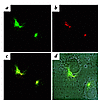 Confocal microscopy on CS-1 and activated β1 colocalization on the apical s