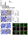 High level of TGF-β1 induces expression of CatL.