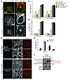 Prolonged loss of CD2AP leads to expression of cytosolic CatL.