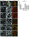 Number of FAs within WT podocytes and high-Tgfb1Cd2ap–/– podocytes with Cat