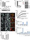 Prolonged CD2AP loss leads to dendrin translocation into the nucleus.