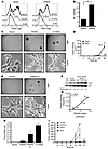 TRAF6 overexpression causes malignant phenotype.