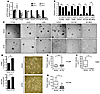 Inhibition of TRAF6 impairs growth and tumor formation of lung cancer cells