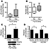 TRAF6 is upstream of NF-κB in human lung cancer cells.