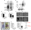 TRAF6 is necessary for RAS-mediated oncogenesis.