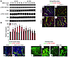 ANG-2 induces in TIE2hi ECs phosphorylation of the integrin adaptor protein