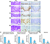 Immunohistochemical expression of MUC6 and αGlcNAc in human pyloric mucosa,