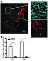 NKT cells preferentially localize to hypoxic areas within tumor tissues.