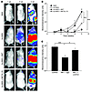 NKT/IL-15 cells have potent antitumor activity in a metastatic NB model in