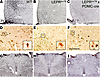 LEPRs are only reactivated in the ARH in LeprloxTB × POMC-cre mice.