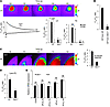 Effect of STIM1 deficiency on Ca2+ signaling.