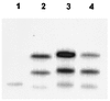 Southern blot analysis of Cd36. The Cd36 deletion variant is present in the