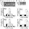 JNK phosphorylation in liver is higher in Mkp1–/– and GRdim/dim mice.