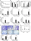 Jnk2–/– mice are resistant to TNF-induced shock.