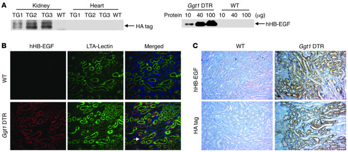 hHB-EGF (DTR) was selectively expressed in renal proximal tubule in Ggt1...