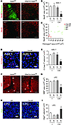 Reduced neuropathology in GfapCre:Vegfafl/fl animals.