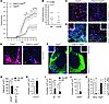 Restricted clinical deficit and tissue damage in EAE in GfapCre:Vegfafl/fl