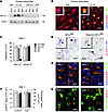 GfapCre:Hif1afl/fl mice show normal VEGF-A expression and BBB opening in in