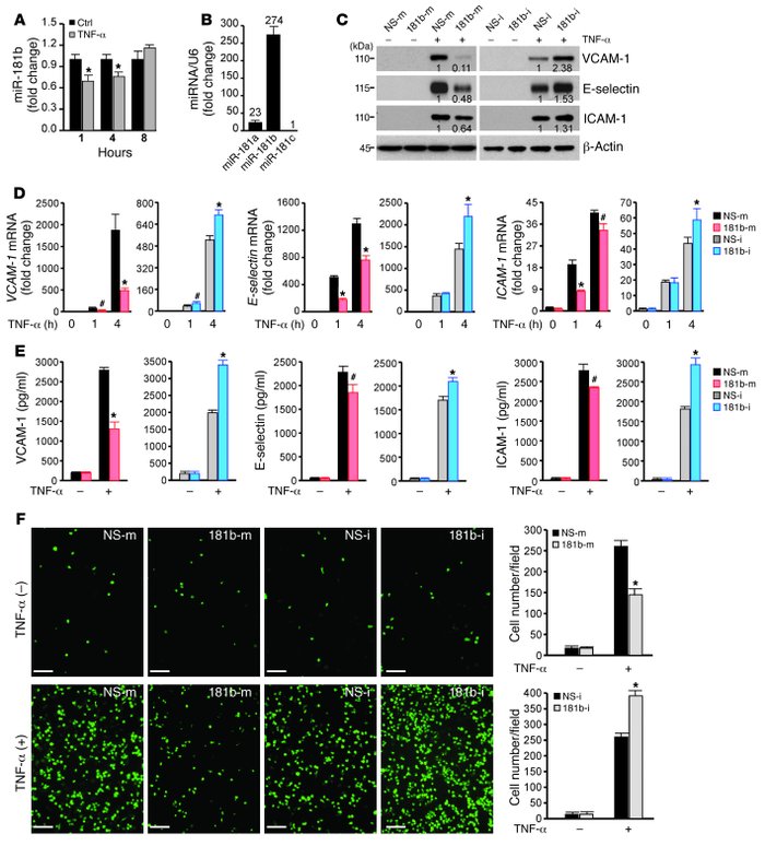 miR-181b suppresses TNF-α–induced proinflammatory gene expression in HUV...