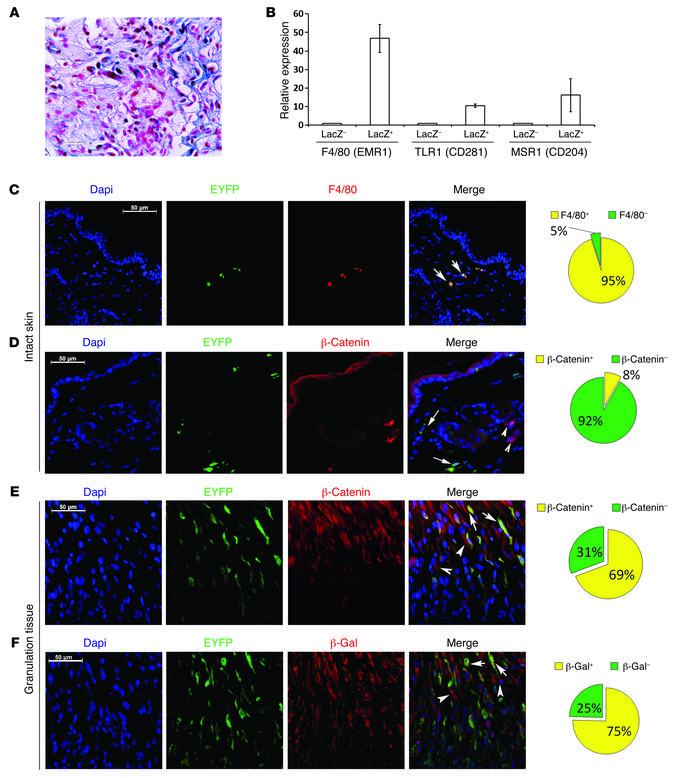 Tcf transcriptionally active cells express genes characteristic of macro...