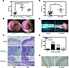 NOD2-driven risk for colitis-associated colorectal cancer is communicable t