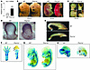 Flvcr1a–/– embryos show hemorrhages, edema, and skeletal malformations.