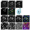 Immunohistochemistry of the MSC-DP–engrafted striatum.