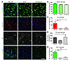 Quantitative analysis of immunohistochemistry of the dorsal posterior stria