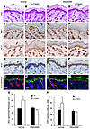 Topical p38 inhibition attenuates skin abnormalities in Fgfr2+/Y394C mice.