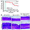 Aag–/–Alkbh2–/–Alkbh3–/– mice do not survive AOM/DSS treatment.