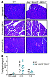 Aag–/–Alkbh2–/–Alkbh3–/– mice are capable of recovering from cerulein treat