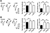 Isoflurane and propofol attenuate the enhancing effects of TXA on evoked fi